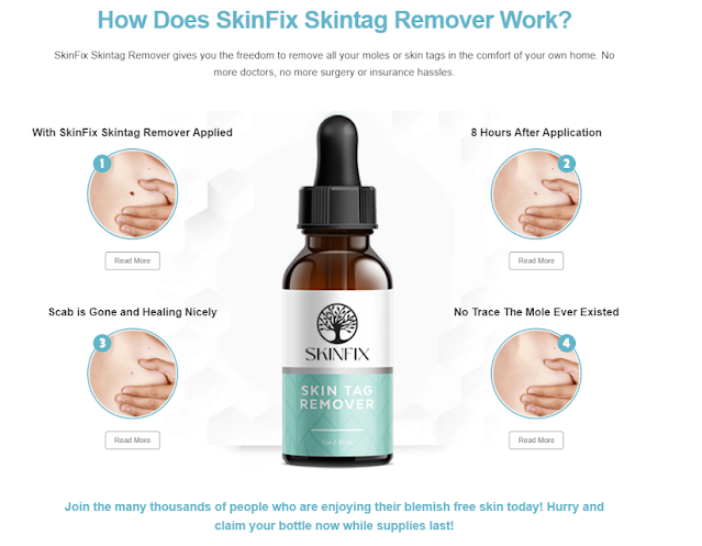 SkinFix Skintag Remover 1